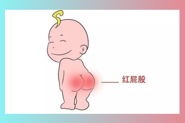 ​宝宝红屁股的原因_怎么预防和护理宝宝的红屁屁 - 月嫂面试常见问答(图1)
